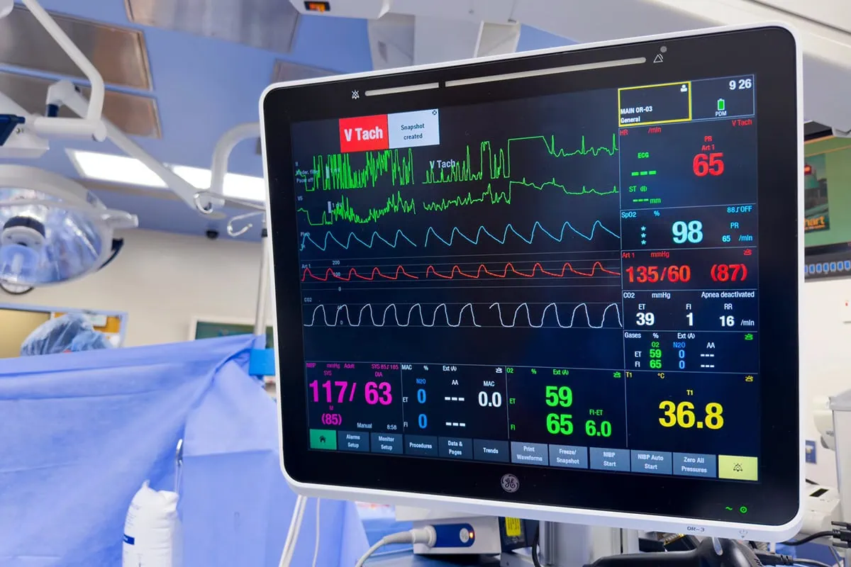a digital display monitoring a patients vital signs.